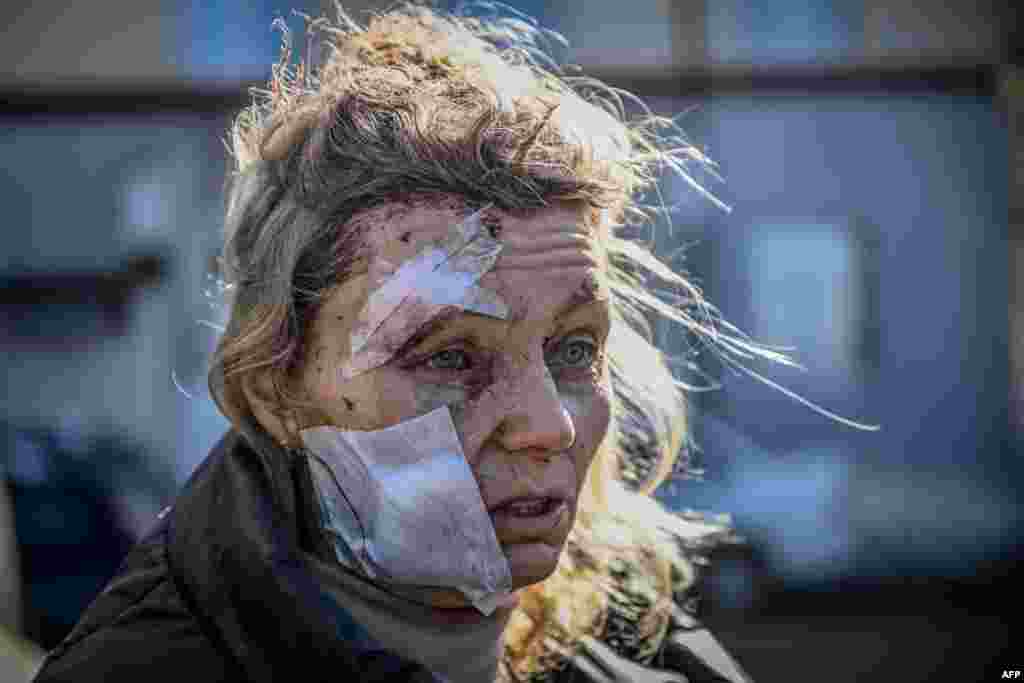 Helena, a 53-year-old teacher, stands outside a hospital after the bombing of the eastern Ukraine town of Chuguiv, Ukraine, Feb. 24, 2022, as Russian armed forces attempt to invade Ukraine from several directions, using rocket systems and helicopters to attack Ukrainian position in the south, the border guard service said.