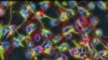 Researchers Seek Ways to Help Damaged Brains Heal