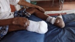 Lepra poderia ser erradicada em Angola com poucos fundos 1:37