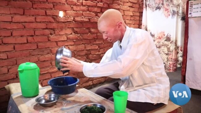 Malawi's Albinos Issued Personal Security Alarms to Stop Attacks Against Them