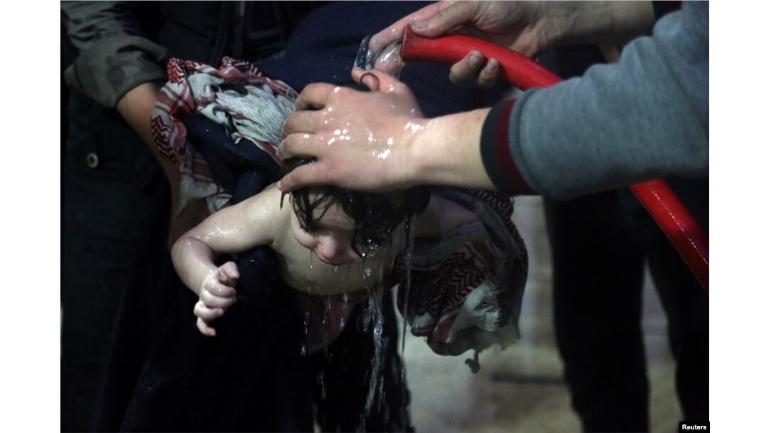 FILE - A child is treated in a hospital in Douma, eastern Ghouta in Syria, after what a Syria medical relief group claims was a suspected chemical attack, April 7, 2018.