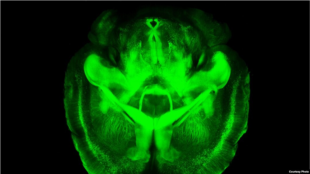 A three-dimensional rendering of clarified brain (Courtesy of the Deisseroth lab)