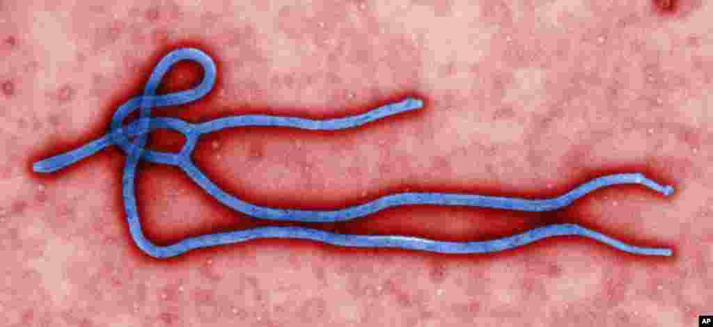 Ảnh do trung tâm CDC cho thấy một loại virus Ebola. Các giới chức y tế Mỹ đang giám sát các ổ dịch Ebola ở Châu Phi.