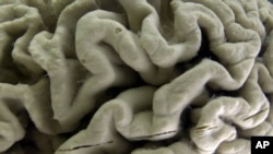 Una sección de un cerebro con Alzheimer en exhibición en el museo de Neuroanatomía de la Universidad de Buffalo, Nueva York.