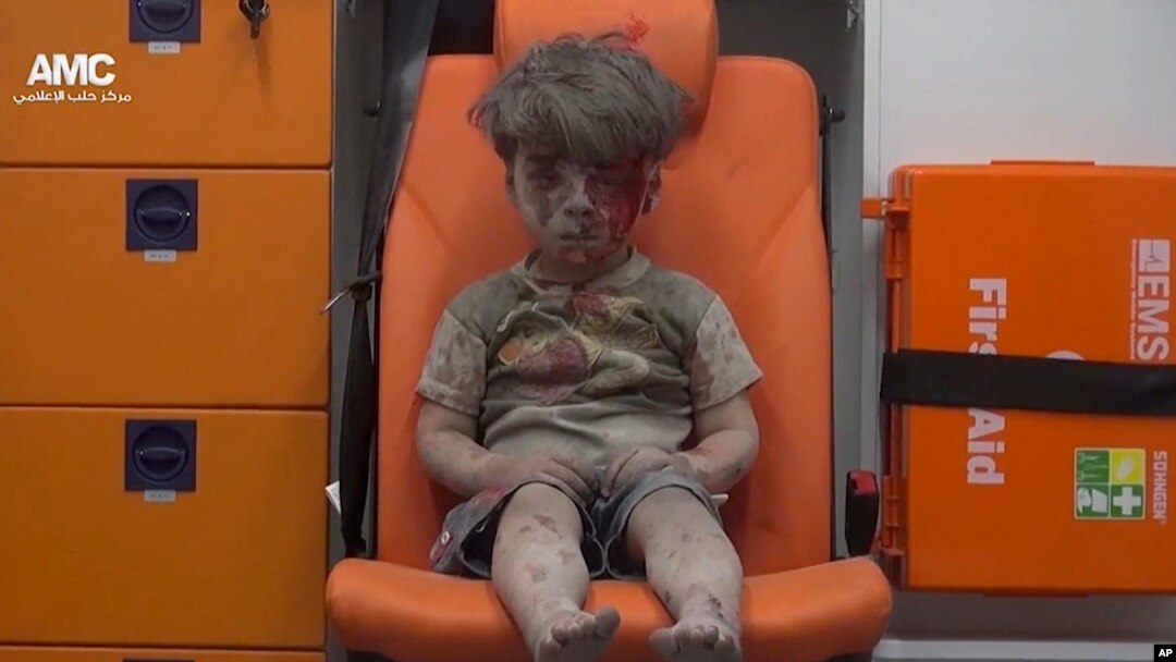 Hoton Omran Dangneesh dan shekara biyar da aka raunata ssnadiyar harin jirgin sama da aka kai kan birnin Aleppo dake kasar Siriya